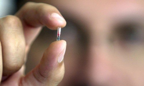 İsveç’te Binlerce İnsan Kimlik Kartlarını Mikroçip ile Derilerinin Altına Yerleştiriyor